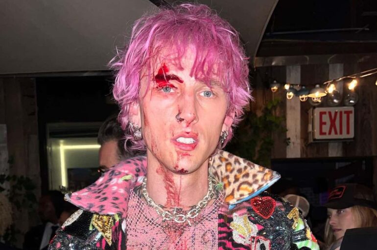Video Of Machine Gun Kelly Bleeding After Shattering A Glass On His Forehead